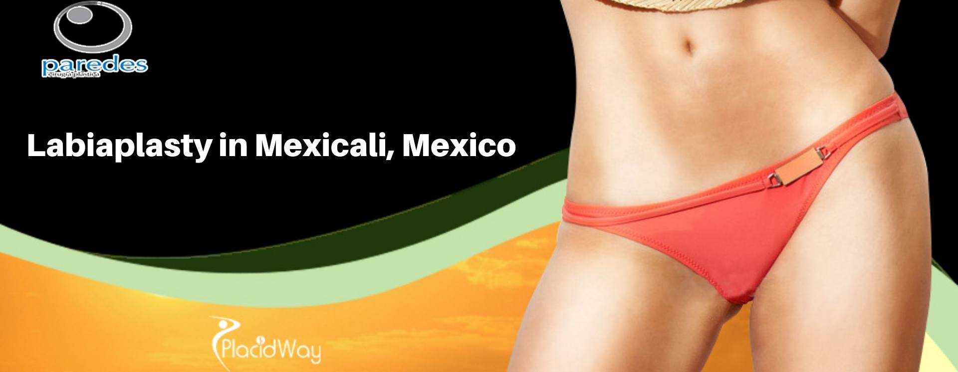 Labioplastia en Mexicali, México Labiaplasty in Mexicali, Mexico